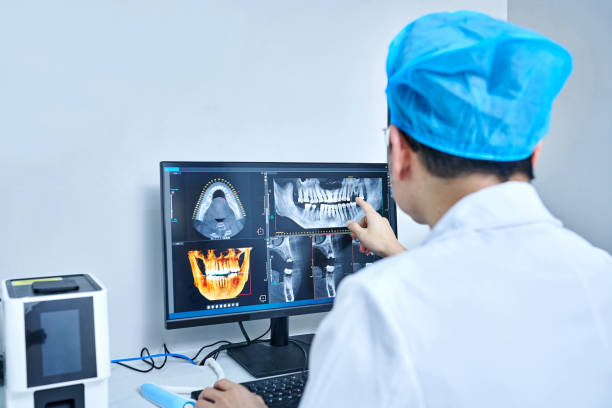 Best Emergency Wisdom Tooth Extraction in Montrose, CO